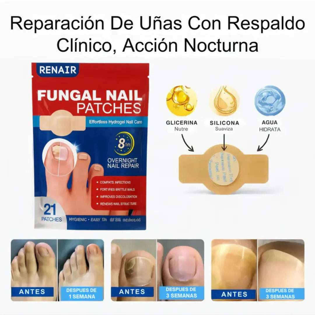 FungalFix™ - Parches Anti Hongos